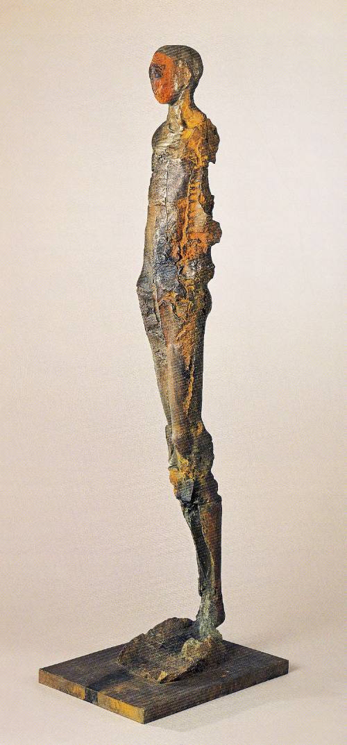 Standing Man with Hollow Calf